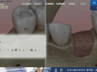 【#八千代緑が丘】医療法人社団 志由会 マイ歯科医院-保険適用の白い歯