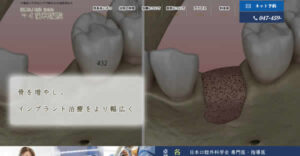 【#八千代緑が丘】医療法人社団 志由会 マイ歯科医院-保険適用の白い歯
